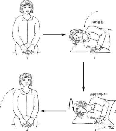 耳石復位法|三類BPPV「耳石復位」操作全面總結